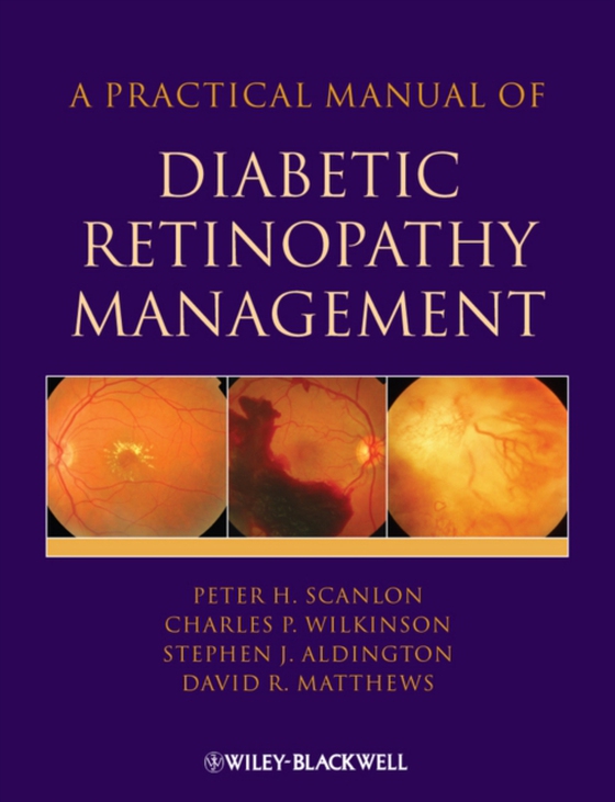 Practical Manual of Diabetic Retinopathy Management