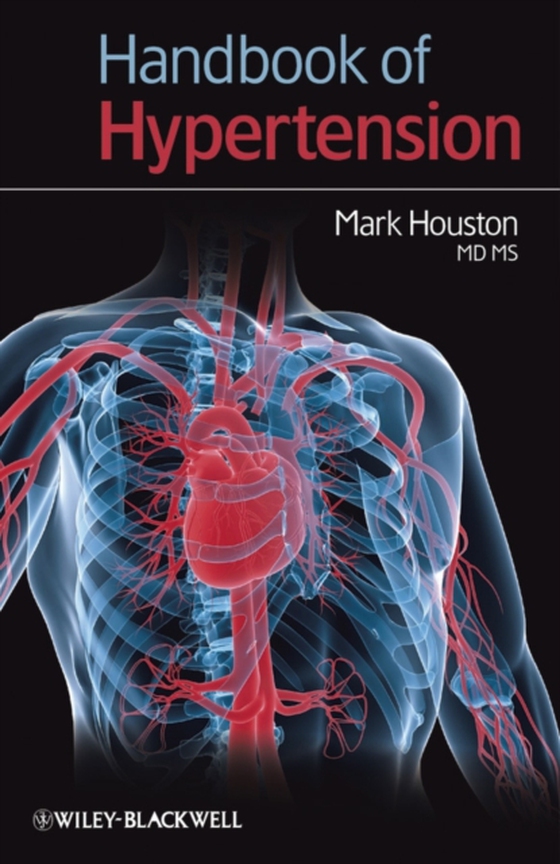 Handbook of Hypertension (e-bog) af Houston, Mark