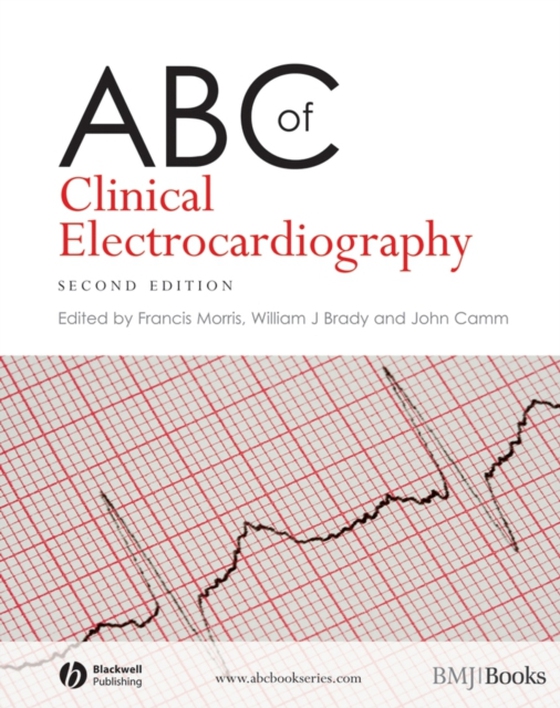 ABC of Clinical Electrocardiography (e-bog) af -