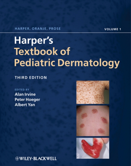 Harper's Textbook of Pediatric Dermatology (e-bog) af -