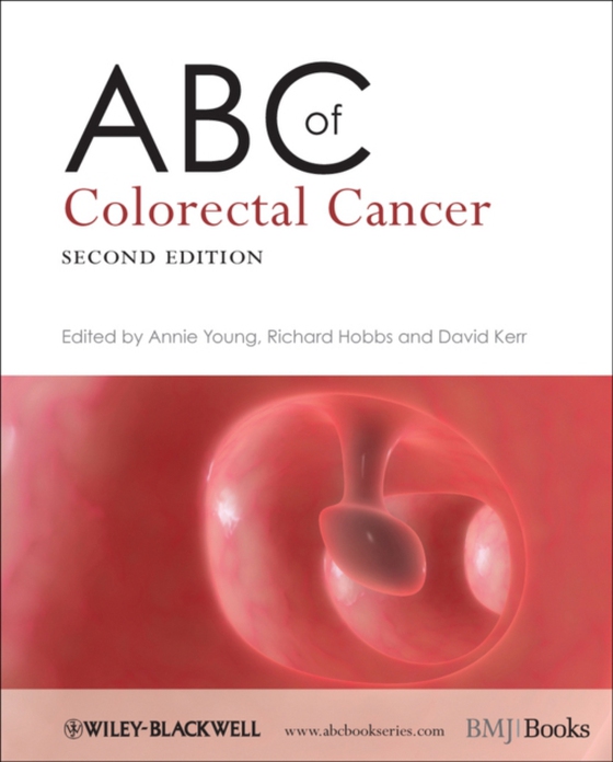 ABC of Colorectal Cancer (e-bog) af -