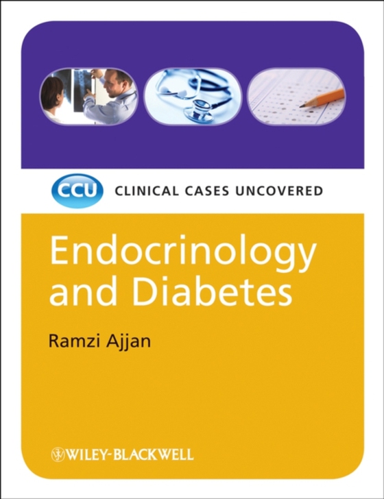 Endocrinology and Diabetes, eTextbook (e-bog) af Ajjan, Ramzi