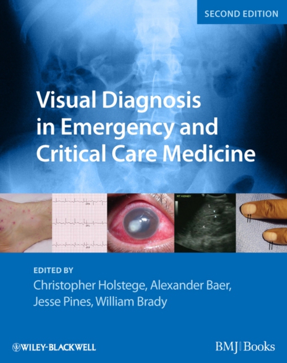 Visual Diagnosis in Emergency and Critical Care Medicine (e-bog) af Brady, William J.