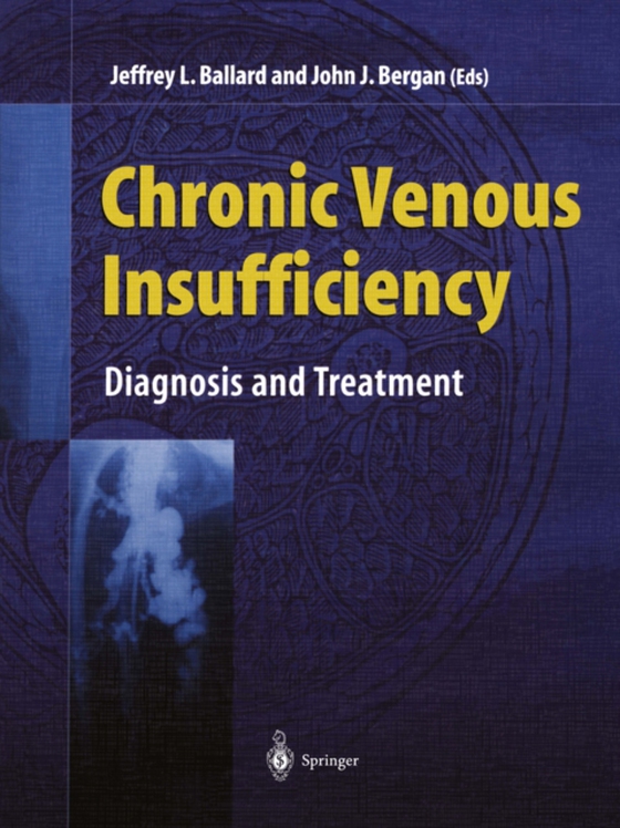 Chronic Venous Insufficiency (e-bog) af -