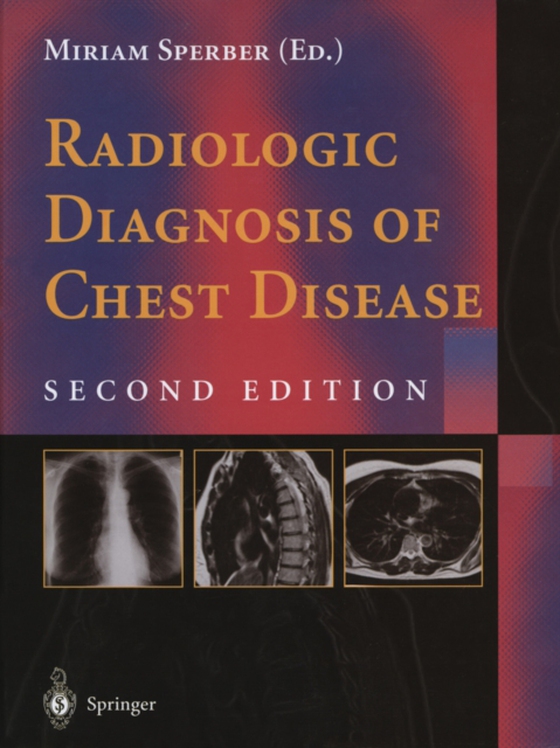 Radiologic Diagnosis of Chest Disease (e-bog) af -