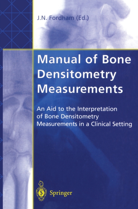 Manual of Bone Densitometry Measurements (e-bog) af -