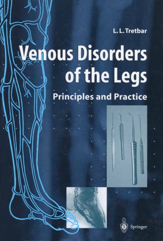 Venous Disorders of the Legs (e-bog) af Tretbar, Lawrence L.