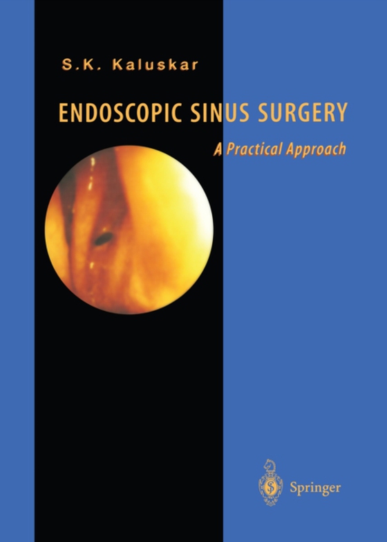 Endoscopic Sinus Surgery (e-bog) af Kaluskar, Shashikant K.