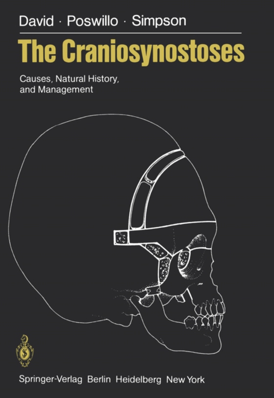 Craniosynostoses (e-bog) af Simpson, D.