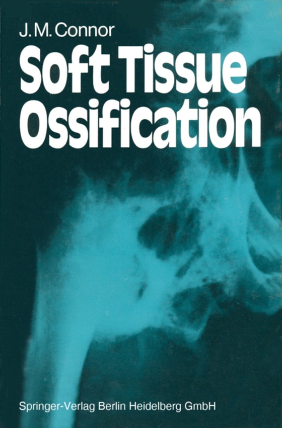 Soft Tissue Ossification (e-bog) af Connor, J. M.