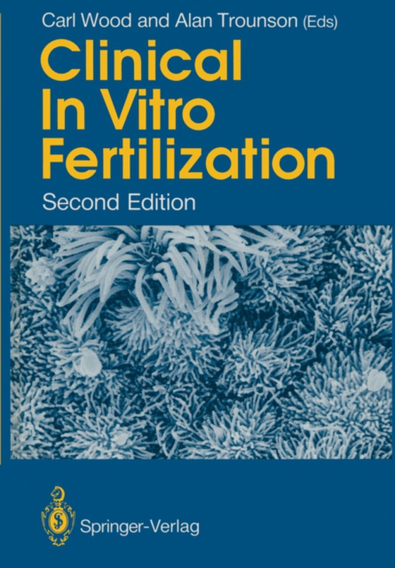 Clinical In Vitro Fertilization (e-bog) af -