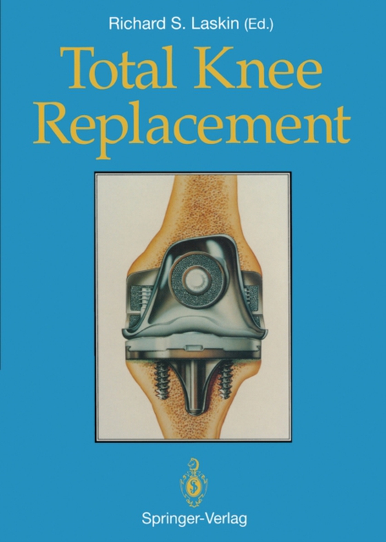 Total Knee Replacement (e-bog) af -