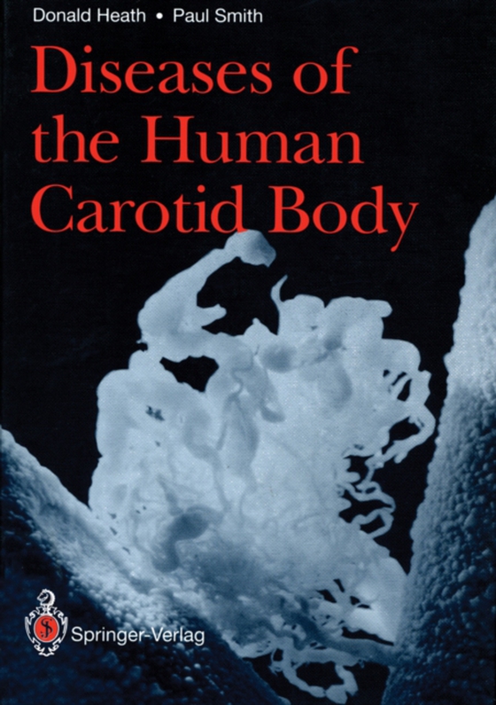 Diseases of the Human Carotid Body (e-bog) af Smith, Paul