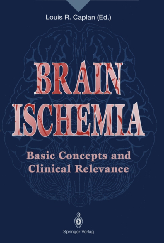 Brain Ischemia (e-bog) af -