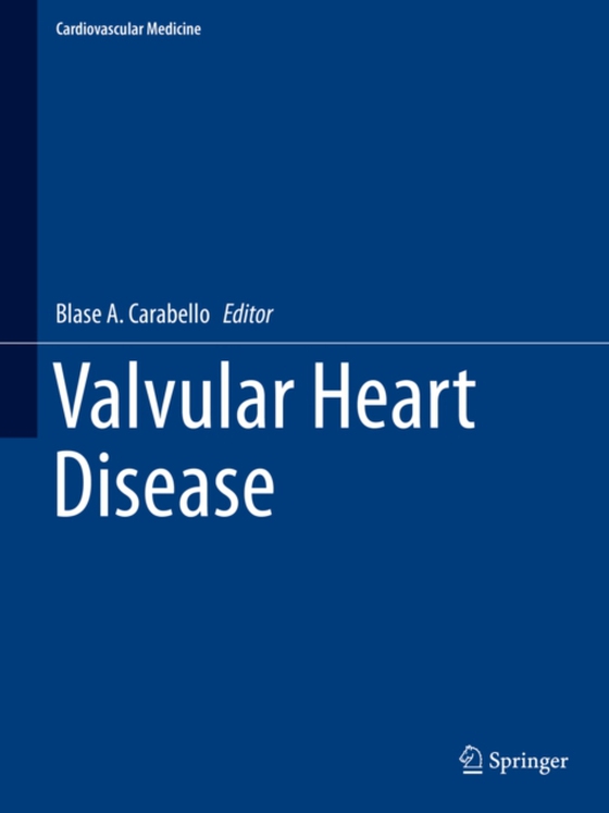 Valvular Heart Disease (e-bog) af -