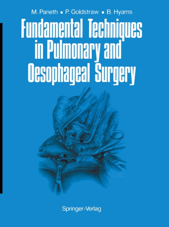 Fundamental Techniques in Pulmonary and Oesophageal Surgery (e-bog) af Hyams, Barbara E.