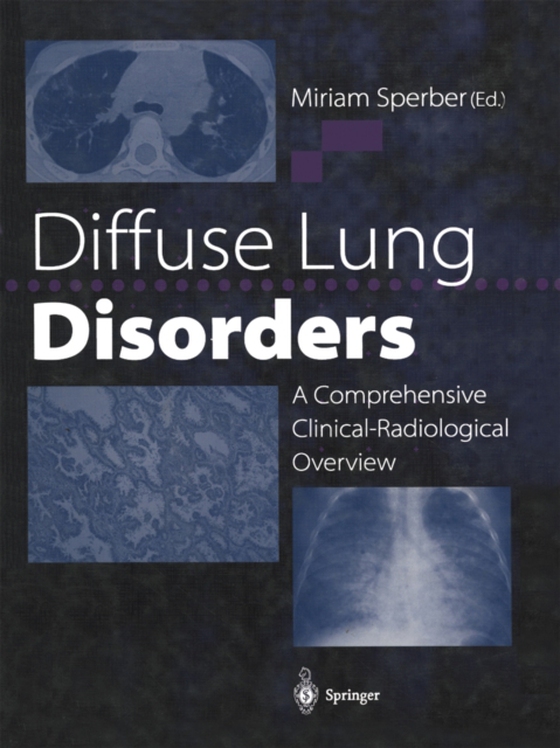 Diffuse Lung Disorders (e-bog) af -