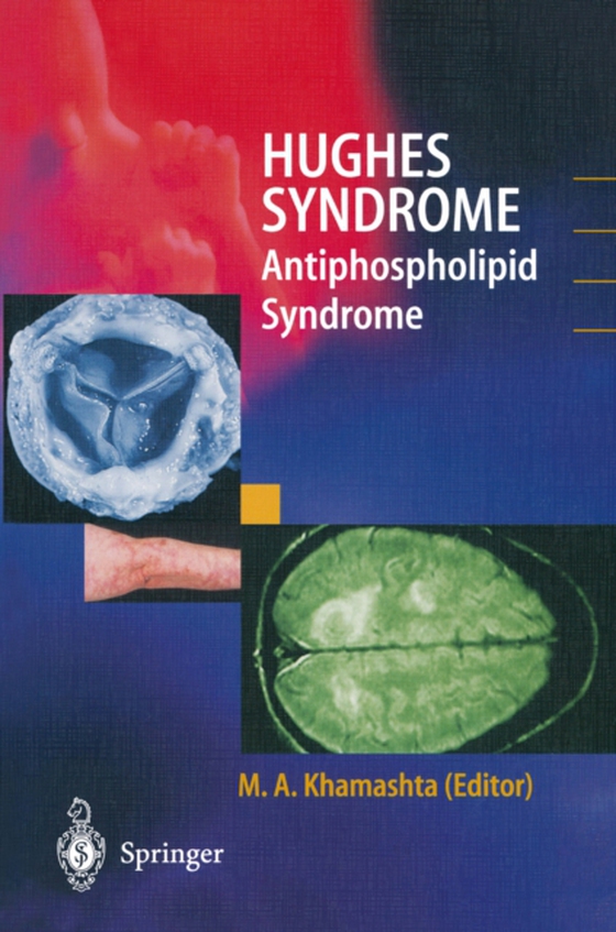 Hughes Syndrome (e-bog) af -