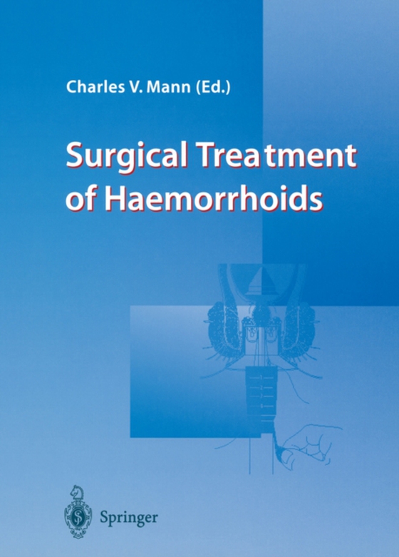 Surgical Treatment of Haemorrhoids (e-bog) af -