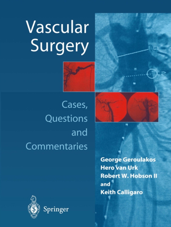 Vascular Surgery (e-bog) af -