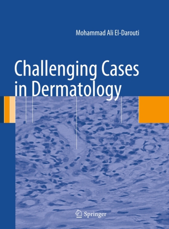 Challenging Cases in Dermatology (e-bog) af El-Darouti, Mohammad Ali