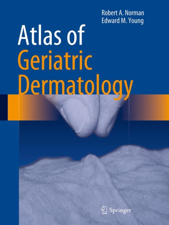 Atlas of Geriatric Dermatology (e-bog) af Edward M. Young, Jr