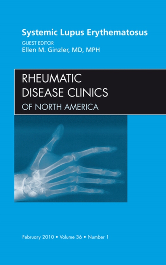 Systemic Lupus Erythematosus, An Issue of Rheumatic Disease Clinics (e-bog) af Ginzler, Ellen M.