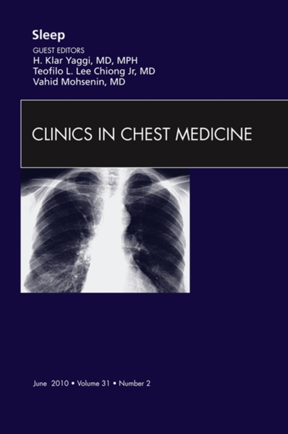 Sleep, An Issue of Clinics in Chest Medicine