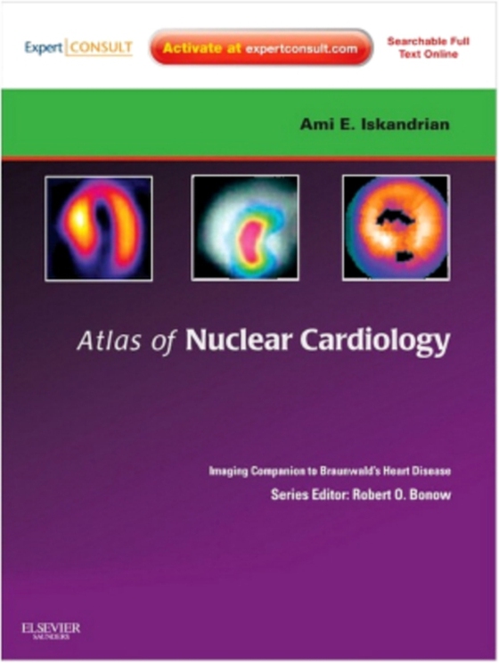 Atlas of Nuclear Cardiology: Imaging Companion to Braunwald's Heart Disease E-Book