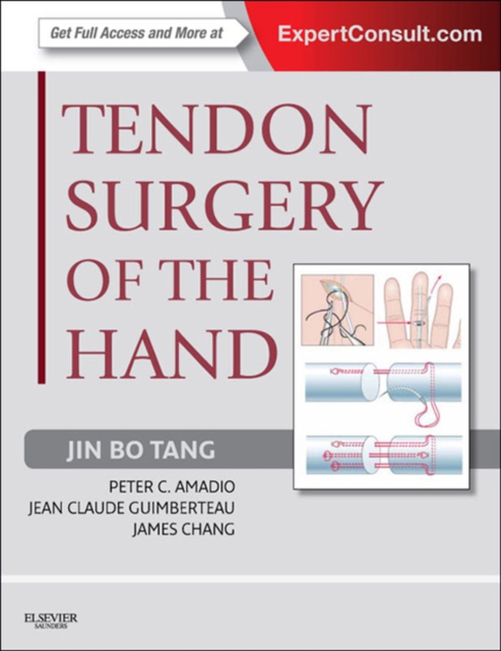 Tendon Surgery of the Hand E-Book (e-bog) af Chang, James