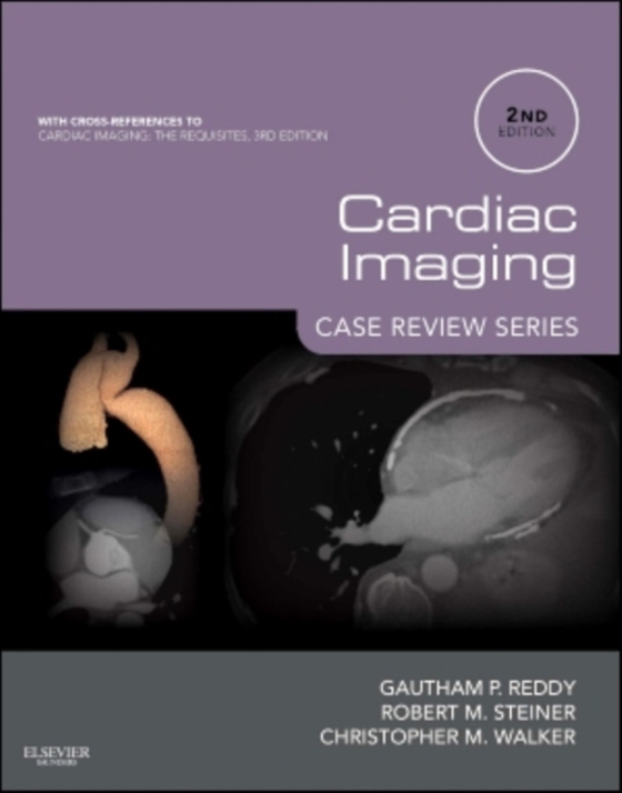 Cardiac Imaging: Case Review Series E-Book