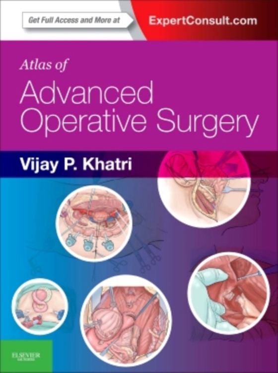 Atlas of Advanced Operative Surgery E-Book