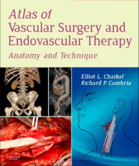 Atlas of Vascular Surgery and Endovascular Therapy E-Book (e-bog) af Chaikof, Elliot L.