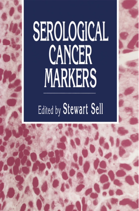 Serological Cancer Markers (e-bog) af -