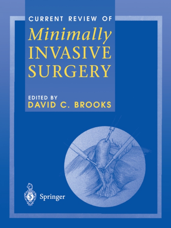 Current Review of Minimally Invasive Surgery (e-bog) af -