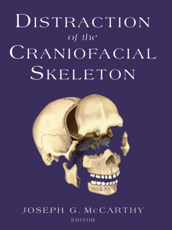 Distraction of the Craniofacial Skeleton (e-bog) af -