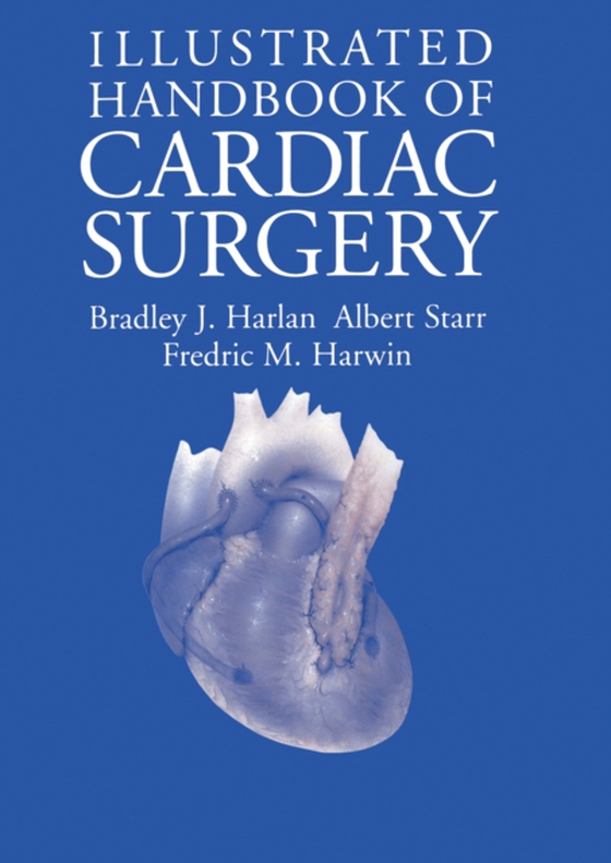 Illustrated Handbook of Cardiac Surgery (e-bog) af Harwin, Fredric M.