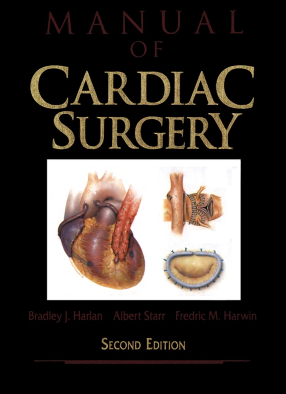 Manual of Cardiac Surgery (e-bog) af Harwin, Fredric M.