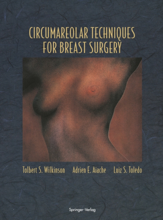 Circumareolar Techniques for Breast Surgery (e-bog) af Toledo, Luiz S.