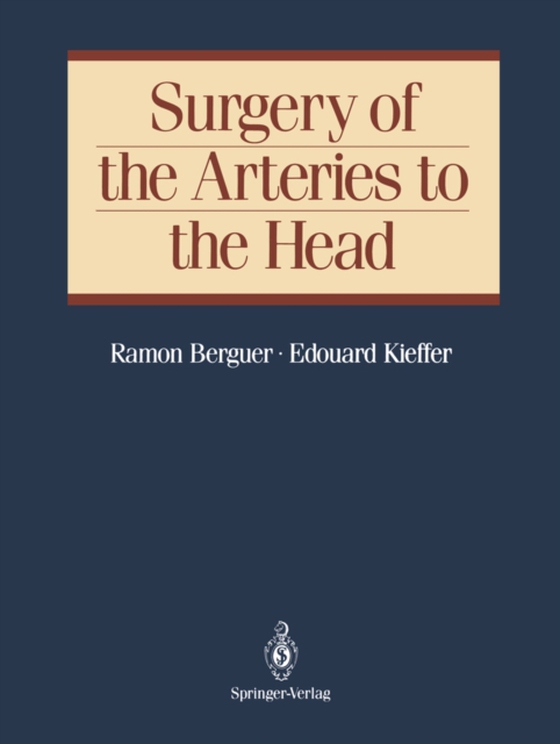 Surgery of the Arteries to the Head (e-bog) af Kieffer, Edouard