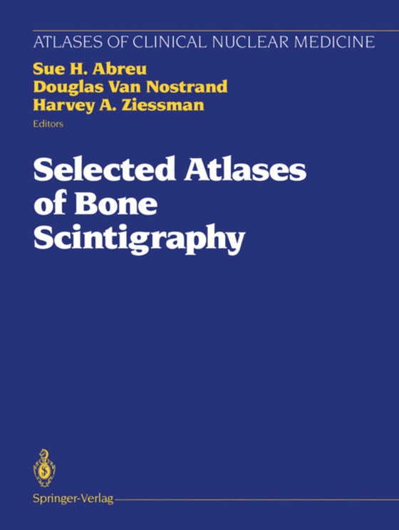 Selected Atlases of Bone Scintigraphy (e-bog) af -