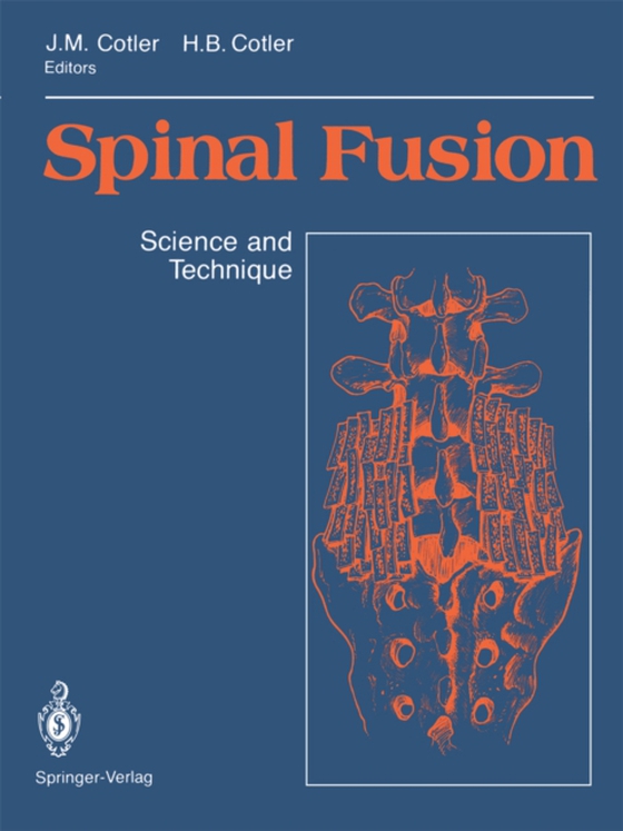 Spinal Fusion (e-bog) af -