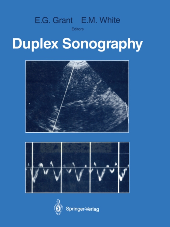 Duplex Sonography (e-bog) af -