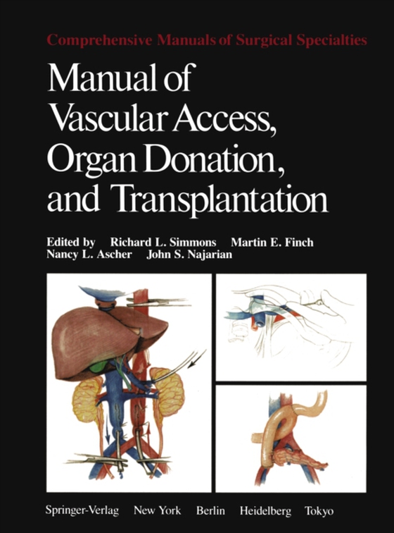 Manual of Vascular Access, Organ Donation, and Transplantation (e-bog) af -