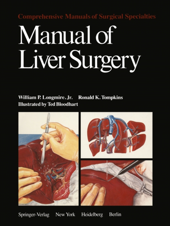 Manual of Liver Surgery (e-bog) af Tompkins, R.K.