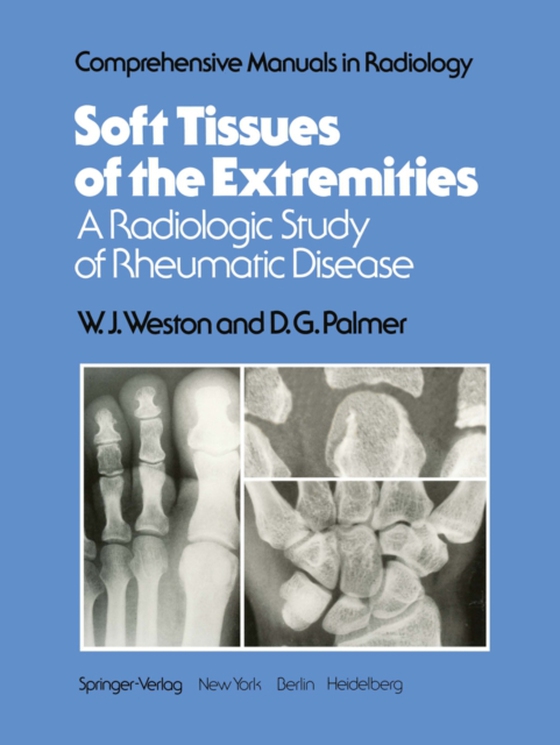 Soft Tissues of the Extremities (e-bog) af Palmer, D. G.