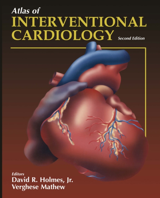 Atlas of Interventional Cardiology (e-bog) af -