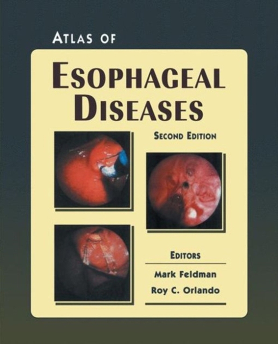 Atlas of Esophageal Diseases (e-bog) af -