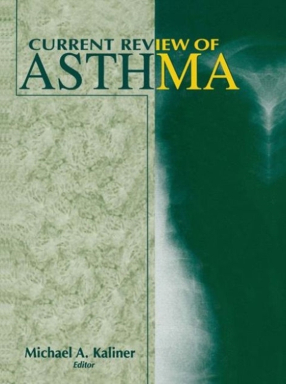 Current Review of Asthma (e-bog) af -