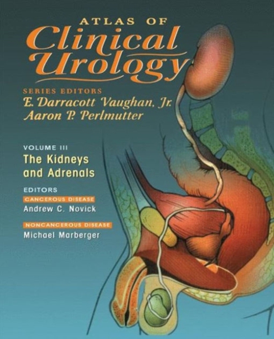 Atlas of Clinical Urology (e-bog) af -